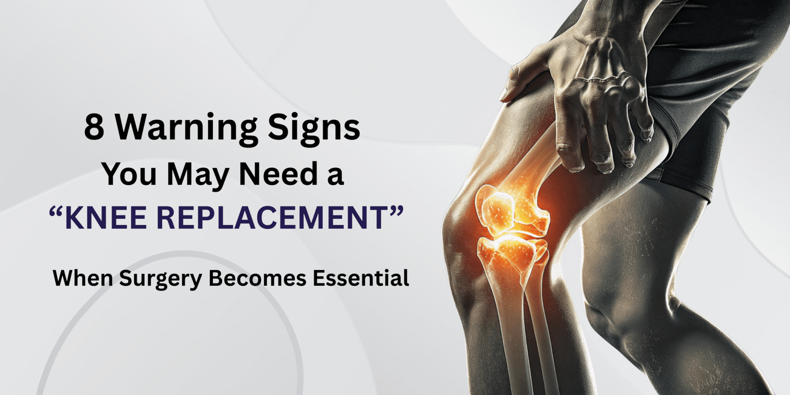 8 Warning Signs You May Need a Knee Replacement
