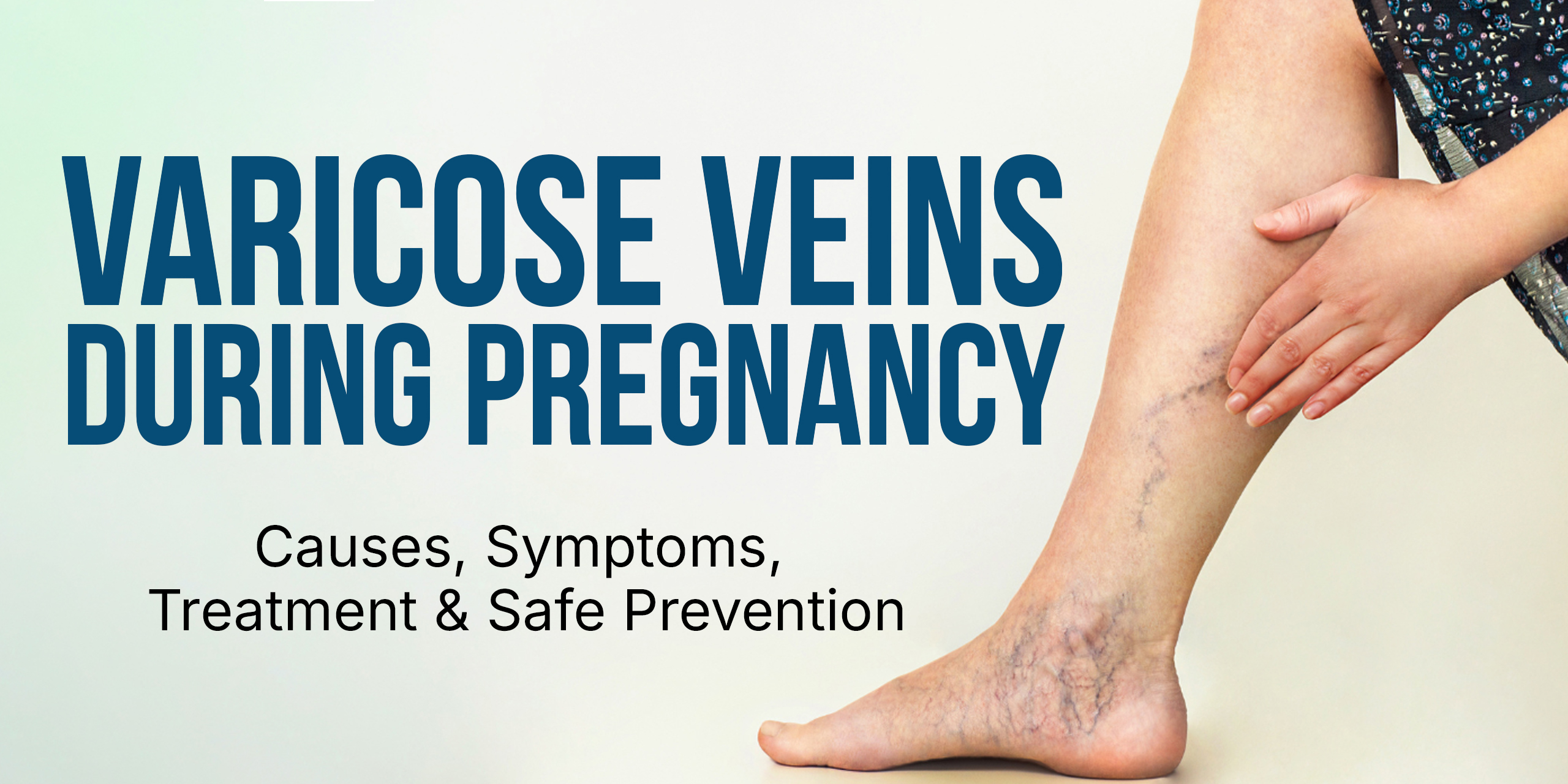 Varicose Veins During Pregnancy – Causes, Symptoms, Treatment & Safe Prevention