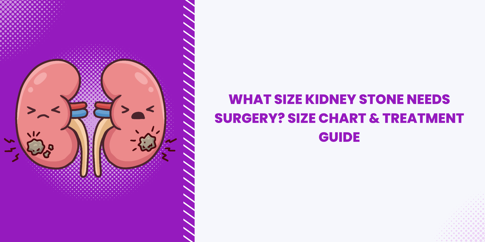What Size Kidney Stone Needs Surgery? Size Chart & Treatment Guide