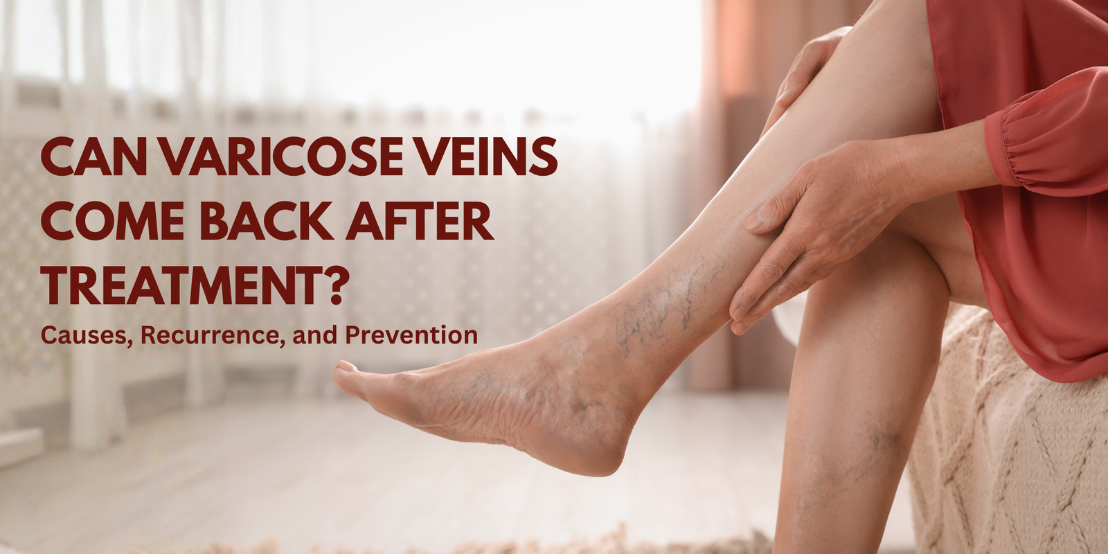 Can Varicose Veins Come Back After Treatment? Causes, Recurrence, and Prevention