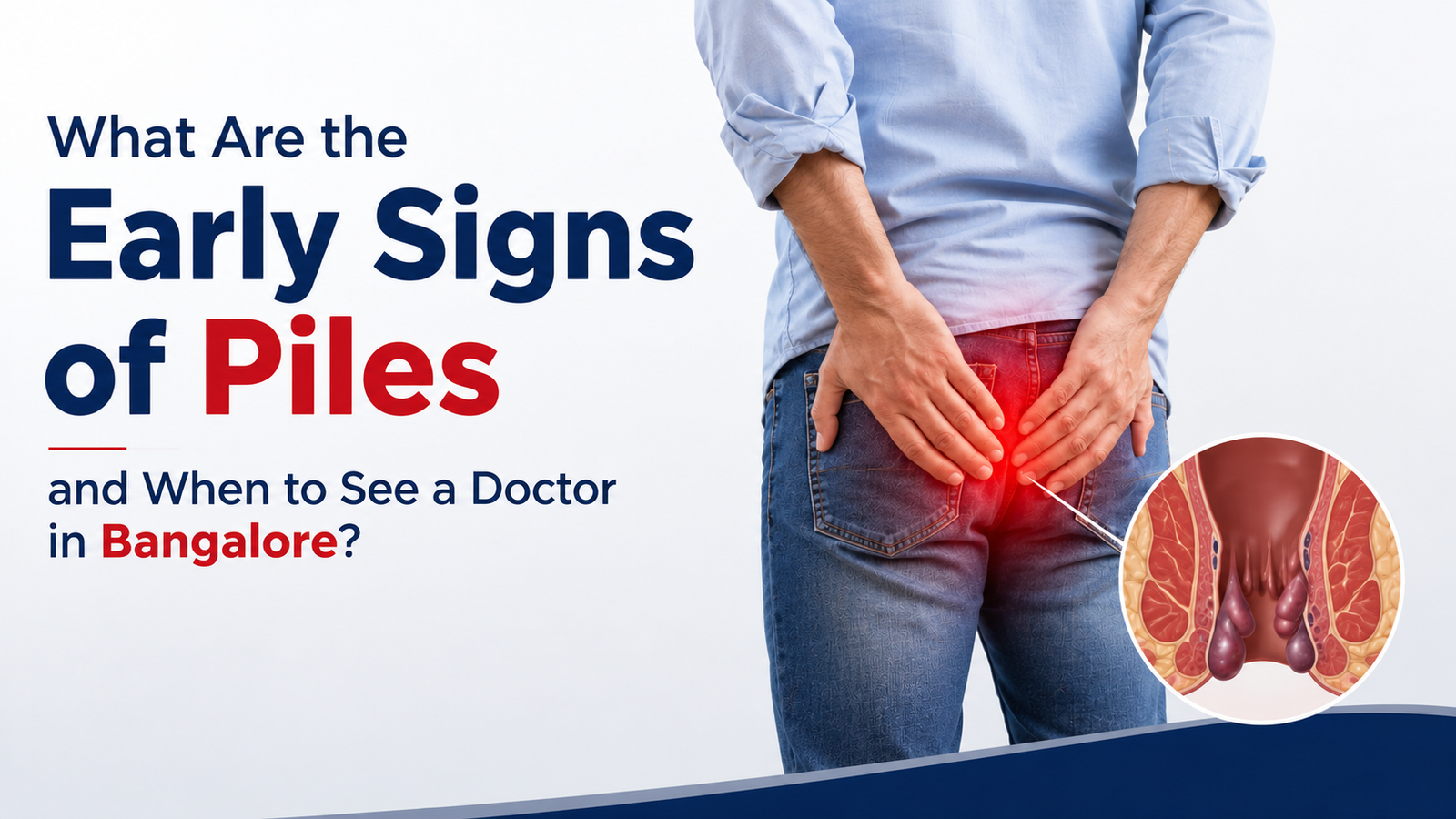 early signs of piles