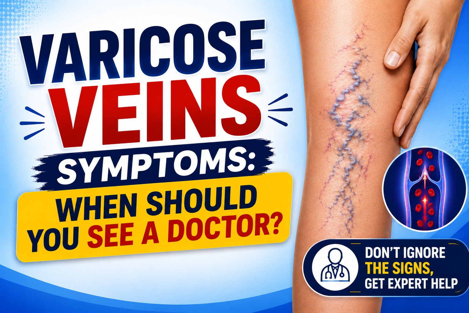 Varicose Veins Symptoms