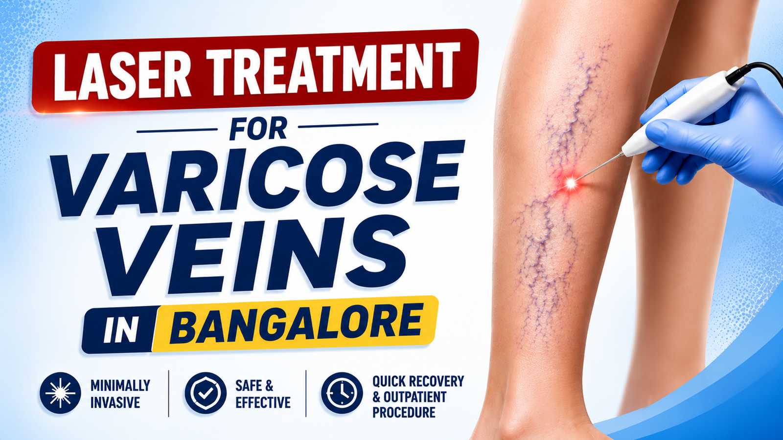 Laser Treatment for Varicose Veins in Bangalore